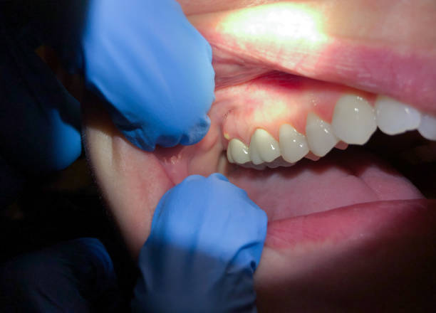 Best Pediatric Emergency Dentist in Winterville, GA