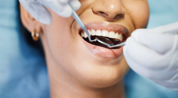 Best Emergency Dentist for Lost Fillings or Crowns in Winterville, GA